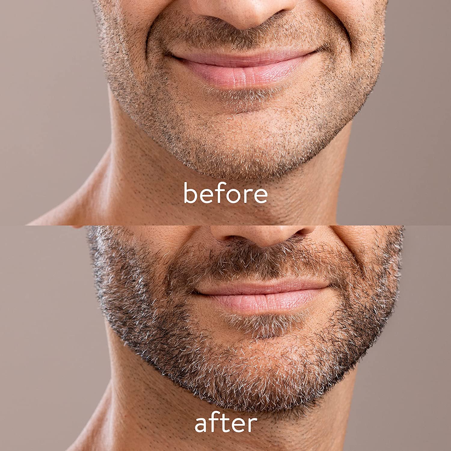 Navaris Derma Roller Προσώπου και Γενειάδας για Άνδρες - Black - 57999.01